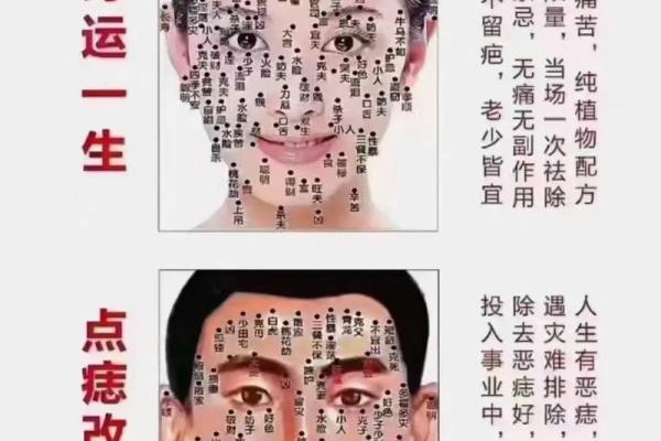 手掌痣相解析：女人运势与性格的神奇暗示