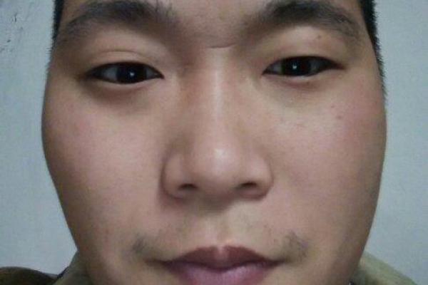 鼠目寸光，揭秘面相中的财富密码