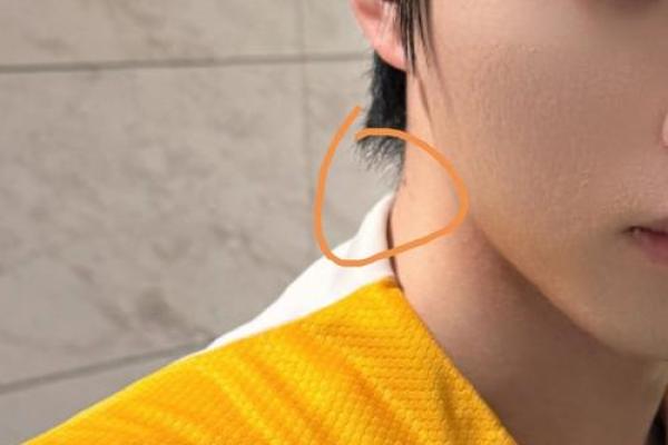 脖子上的痣，锁住你的独特风情