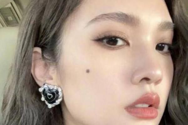 脖子上的痣，锁住你的独特风情