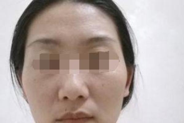 揭秘马蓉面相：面相专家揭秘她为何婚姻不幸