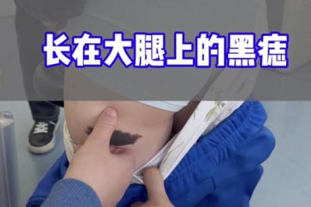 女人腿痣相揭秘：哪些痣让你财运亨通？
