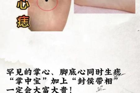 手上痣相全解析：揭秘你的性格与运势