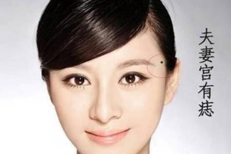出轨的预兆？揭秘外遇痣的神秘面纱