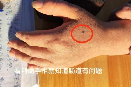 手背有痣，运势如何？揭秘手相中的神秘预示