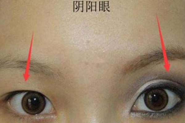 顽疾缠身，面相揭秘：一眼看穿健康隐患