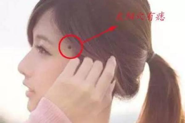 麻衣相殿部长痣揭秘：命运之痣还是瑕疵？