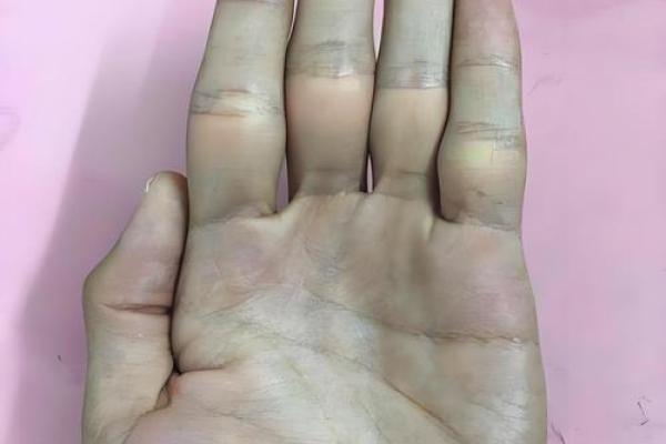 揭秘手相中的神秘信号：无名指青筋透露的健康秘密