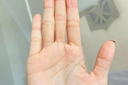 揭秘拇指根部神秘竖线：你的命运密码在这里