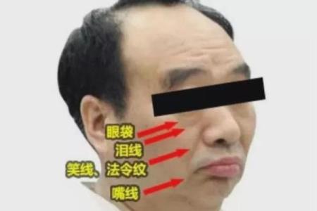 红丝入眼，运势如何？揭秘面相中的红血丝奥秘
